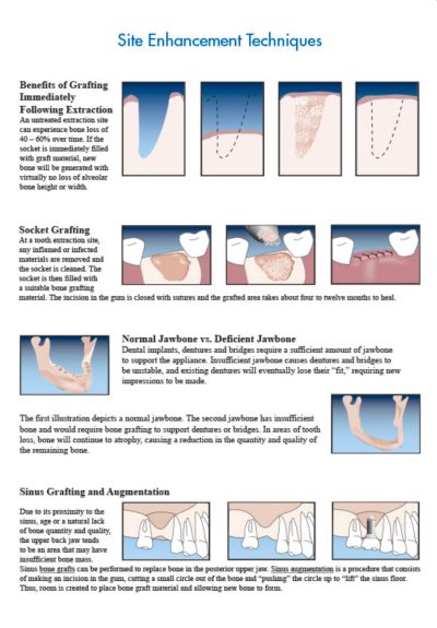 Bone Grafting Image 1